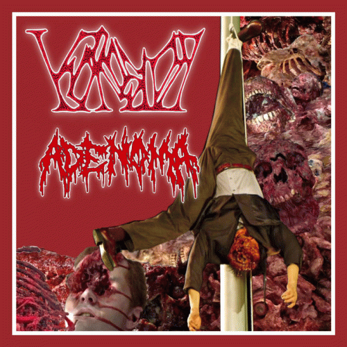 Korosion : Korosion - Adenoma